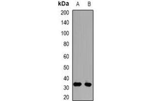 Image no. 1 for anti-Proteasome (Prosome, Macropain) 26S Subunit, Non-ATPase, 9 (PSMD9) (full length) antibody (ABIN6006004)