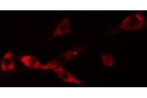 Image no. 2 for anti-Neuroblastoma 1, DAN Family BMP Antagonist (NBL1) (C-Term) antibody (ABIN6256865)