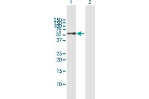 Image no. 2 for anti-Tetratricopeptide Repeat Domain 8 (TTC8) (AA 1-505) antibody (ABIN949824)