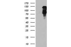 Image no. 2 for anti-F-Box Protein 21 (FBXO21) antibody (ABIN1498235)