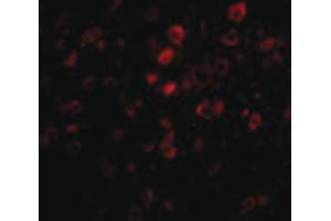 Image no. 2 for anti-Protein Aurora Borealis (BORA) (C-Term) antibody (ABIN6656971)