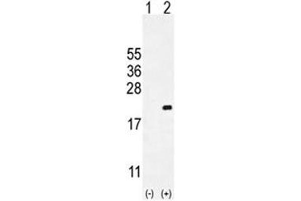 anti-Cyclin-Dependent Kinase Inhibitor 2C (p18, Inhibits CDK4) (CDKN2C) (AA 113-139) antibody
