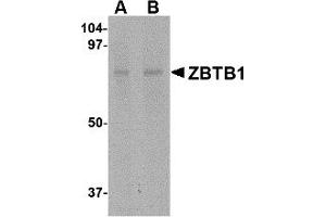 Western Blotting (WB) image for anti-Zinc Finger and BTB Domain Containing 1 (ZBTB1) (Middle Region) antibody (ABIN1031169)
