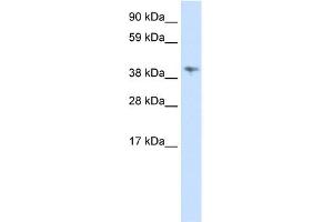 Image no. 1 for anti-Male-Specific Lethal 3 Homolog (MSL3) (C-Term) antibody (ABIN2778442)