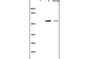 Image no. 1 for anti-Sterol O-Acyltransferase 2 (SOAT2) (AA 331-430) antibody (ABIN708476)