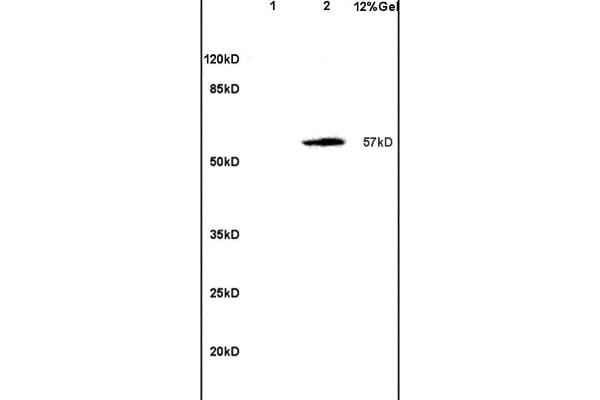 SOAT2 anticorps  (AA 331-430)