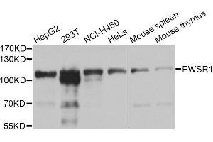 Image no. 2 for anti-Ewing Sarcoma Breakpoint Region 1 (EWSR1) antibody (ABIN1882293)