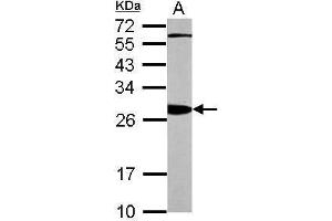 Image no. 5 for anti-14-3-3 alpha + beta (YWHAB) (Center) antibody (ABIN2856888)
