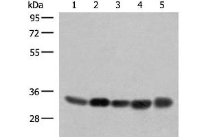 Western blot analysis of 231 PC-3 Hela A375 HepG2 cell lysates using COPE Polyclonal Antibody at dilution of 1:350