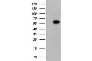 Image no. 2 for anti-Kelch-Like 2, Mayven (KLHL2) (AA 1-100), (AA 494-593) antibody (ABIN2724120)
