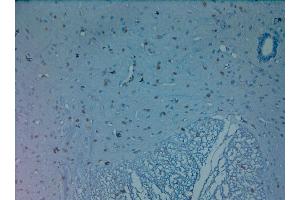 IHC on paraffin sections of rat spinal cord using Rabbit antibody to OLIG2 .