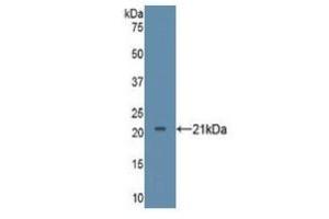 Image no. 3 for Tumor Necrosis Factor alpha (TNF alpha) ELISA Kit (ABIN6574140)
