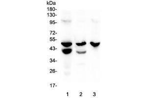 Image no. 2 for anti-Cathepsin E (CTSE) (AA 150-393) antibody (ABIN6654030)