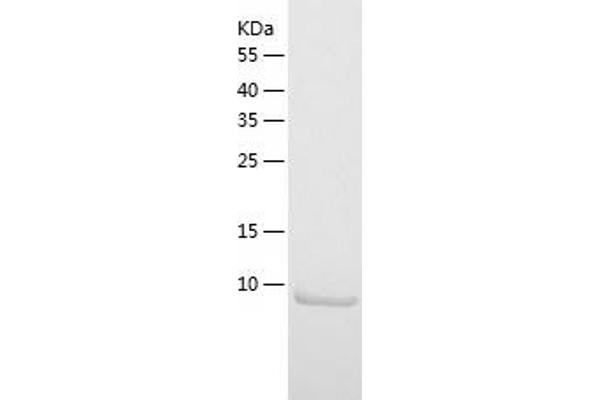 S100A10 Protein (AA 1-97) (His tag)