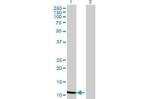 Image no. 1 for anti-WAP Four-Disulfide Core Domain 5 (WFDC5) (AA 1-123) antibody (ABIN1327577)