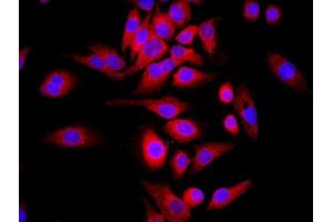 Image no. 1 for anti-WD Repeat Domain 26 (WDR26) (AA 101-200) antibody (ABIN729988)