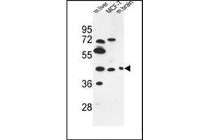 Image no. 1 for anti-Pregnancy Specific beta-1-Glycoprotein 3 (PSG3) (AA 29-58), (N-Term) antibody (ABIN954350)