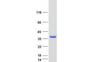 Image no. 1 for Single-Strand-Selective Monofunctional Uracil-DNA Glycosylase 1 (SMUG1) protein (Myc-DYKDDDDK Tag) (ABIN2732266)