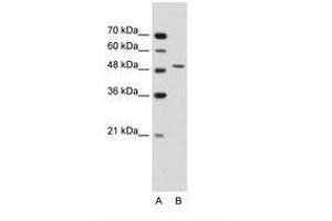 Image no. 3 for anti-Semenogelin I (SEMG1) (AA 51-100) antibody (ABIN203500)