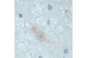 Image no. 10 for anti-Neurotrophic tyrosine Kinase, Receptor, Type 3 (NTRK3) (Extracellular Domain) antibody (ABIN351086)