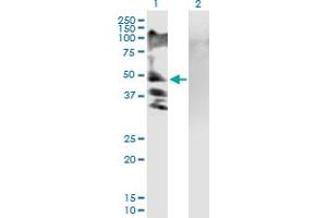 Image no. 1 for anti-Regulatory Solute Carrier Protein, Family 1, Member 1 (RSC1A1) (AA 1-617) antibody (ABIN519924)