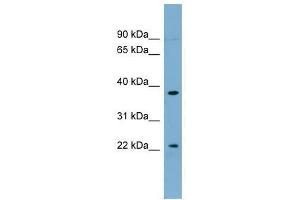 anti-Forkhead Box N4 (FOXN4) (Middle Region) antibody