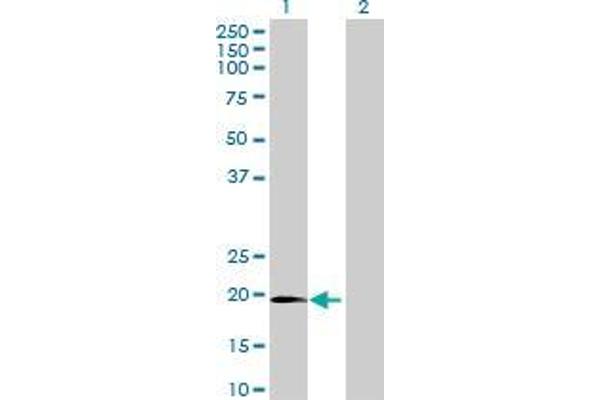 Chromosome 1 Open Reading Frame 84 (C1orf84) (AA 1-178) anticorps