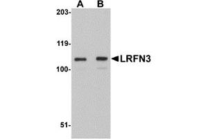 Image no. 1 for anti-Leucine Rich Repeat and Fibronectin Type III Domain Containing 3 (LRFN3) (Middle Region) antibody (ABIN1030988)