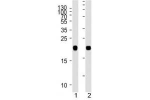 Image no. 2 for anti-GTPase NRas (NRAS) (AA 70-101) antibody (ABIN3028691)