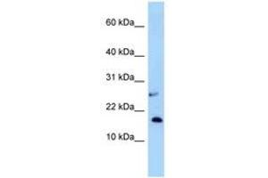 Image no. 1 for anti-Nudix (Nucleoside Diphosphate Linked Moiety X)-Type Motif 15 (NUDT15) (AA 33-82) antibody (ABIN6748042)