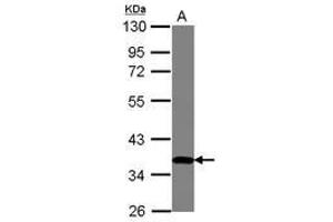 Image no. 1 for anti-Zinc Finger Protein 177 (ZNF177) (AA 113-301) antibody (ABIN1501828)