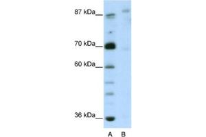 Western Blotting (WB) image for anti-GLIS Family Zinc Finger 3 (GLIS3) antibody (ABIN2461992)