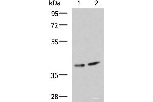 Western blot analysis of Human cerebrum tissue and Mouse brain tissue lysates using PROKR2 Polyclonal Antibody at dilution of 1:800