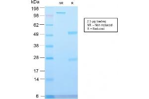 Image no. 1 for anti-Major Vault Protein (MVP) antibody (ABIN6941288)