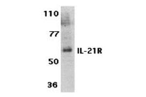 Image no. 2 for anti-Interleukin 21 Receptor (IL21R) (Extracellular Domain) antibody (ABIN1030836)