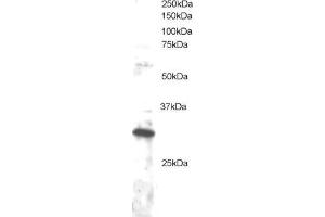 Image no. 1 for anti-Dickkopf Homolog 4 (Xenopus Laevis) (DKK4) (C-Term) antibody (ABIN184710)