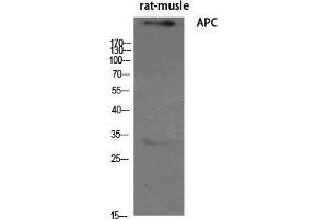 Image no. 2 for anti-Adenomatous Polyposis Coli (APC) (C-Term) antibody (ABIN3183309)