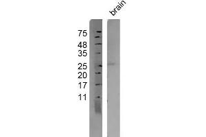 Mouse brain lysates probed with Anti-Persephin Polyclonal Antibody, Unconjugated  at 1:500 overnight at 4˚C.