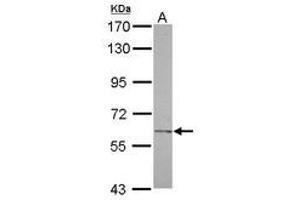 Image no. 1 for anti-Carbohydrate (N-Acetylglucosamine-6-O) Sulfotransferase 2 (CHST2) (AA 246-469) antibody (ABIN1497516)