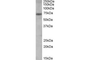 Image no. 3 for anti-Peptidyl Arginine Deiminase, Type IV (PADI4) (N-Term) antibody (ABIN185308)