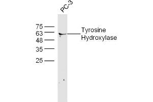 Image no. 3 for anti-Tyrosine Hydroxylase (TH) (AA 115-160) antibody (ABIN723635)