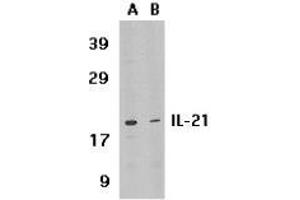 Image no. 2 for anti-Interleukin 21 (IL21) (Intermediate Domain) antibody (ABIN499986)
