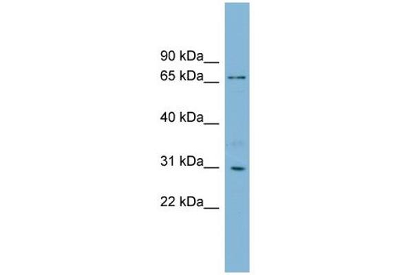 anti-TBCC Domain Containing 1 (TBCCD1) (N-Term) antibody