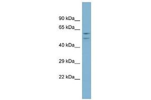 Image no. 1 for anti-ATPase, H+ Transporting, Lysosomal 56/58kDa, V1 Subunit B1 (ATP6V1B1) (Middle Region) antibody (ABIN631587)