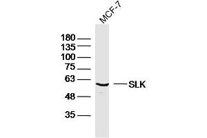 Image no. 1 for anti-STE20-Like Kinase (SLK) (AA 165-270) antibody (ABIN2179263)