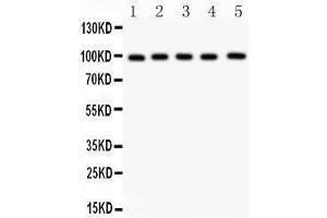 Image no. 1 for anti-Aspartate beta-Hydroxylase (ASPH) (AA 726-758), (C-Term) antibody (ABIN3043790)