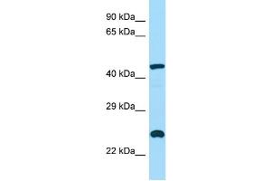 Image no. 1 for anti-Inositol Polyphosphate-5-Phosphatase, 40kDa (INPP5A) (C-Term) antibody (ABIN2790549)
