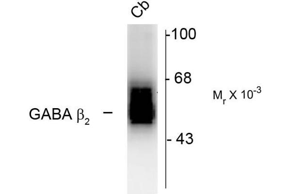 GABRB2 antibody  (Cytoplasmic Loop)