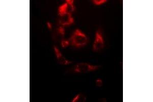 Image no. 1 for anti-NADH Dehydrogenase (Ubiquinone) Flavoprotein 1, 51kDa (NDUFV1) (full length) antibody (ABIN6005838)