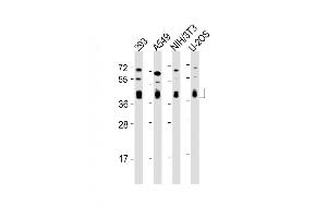 Image no. 6 for anti-BMI1 Polycomb Ring Finger Oncogene (BMI1) antibody (ABIN652702)